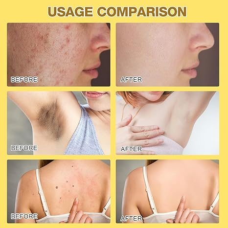 (Buy 1 Get 1 Free) Professional Bee Venom Repair Cream, For All Body Parts