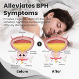 BEEBOOM Nasal Inhaler for Prostate Wellness (Original)